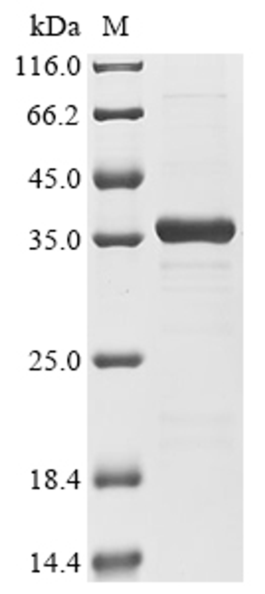 (Tris-Glycine gel) Discontinuous SDS-PAGE (reduced) with 5% enrichment gel and 15% separation gel.