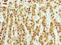 Immunohistochemistry of paraffin-embedded human adrenal gland tissue using CSB-PA002218ESR1HU at dilution of 1:100