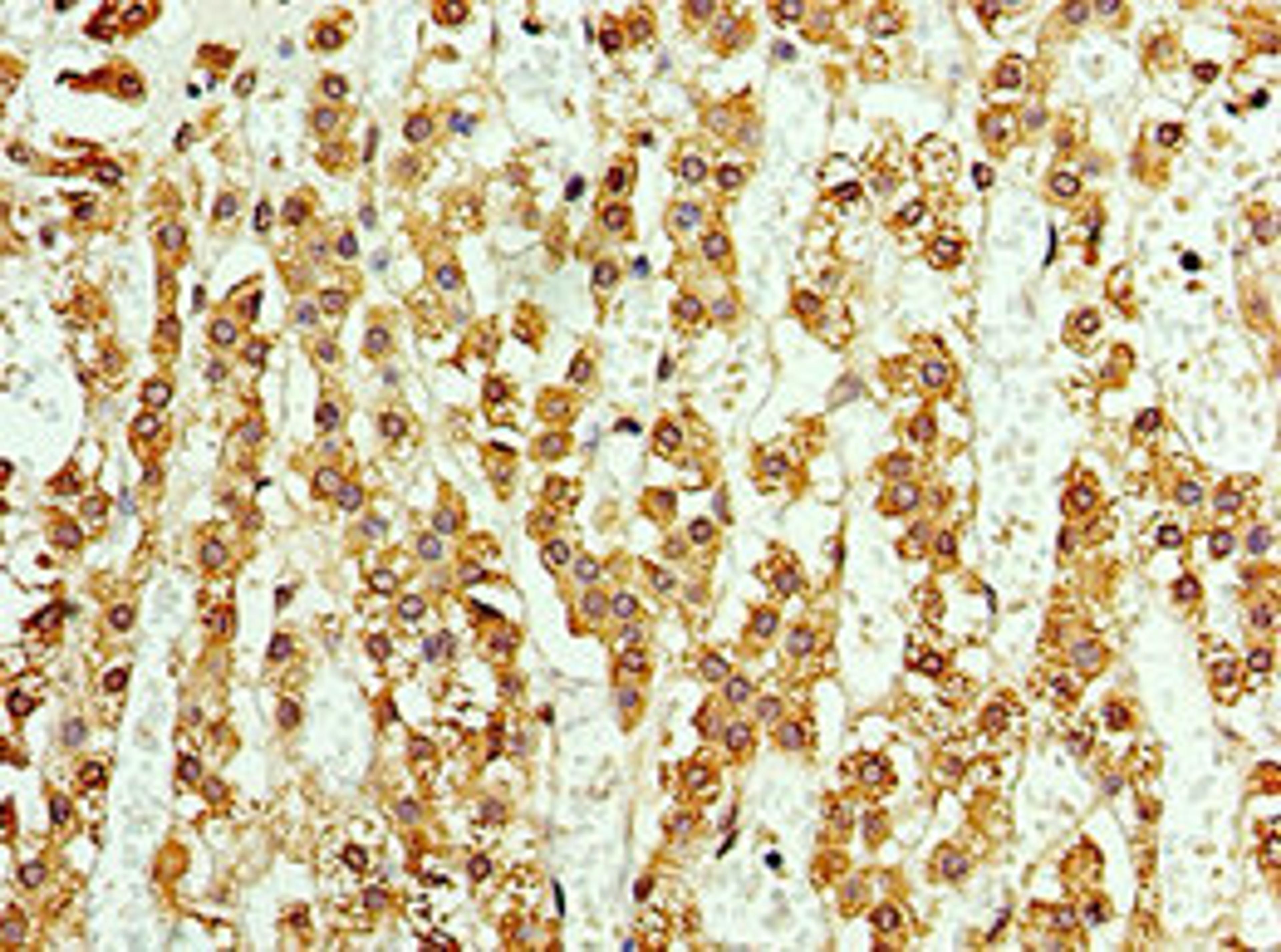 Immunohistochemistry of paraffin-embedded human adrenal gland tissue using CSB-PA002218ESR1HU at dilution of 1:100