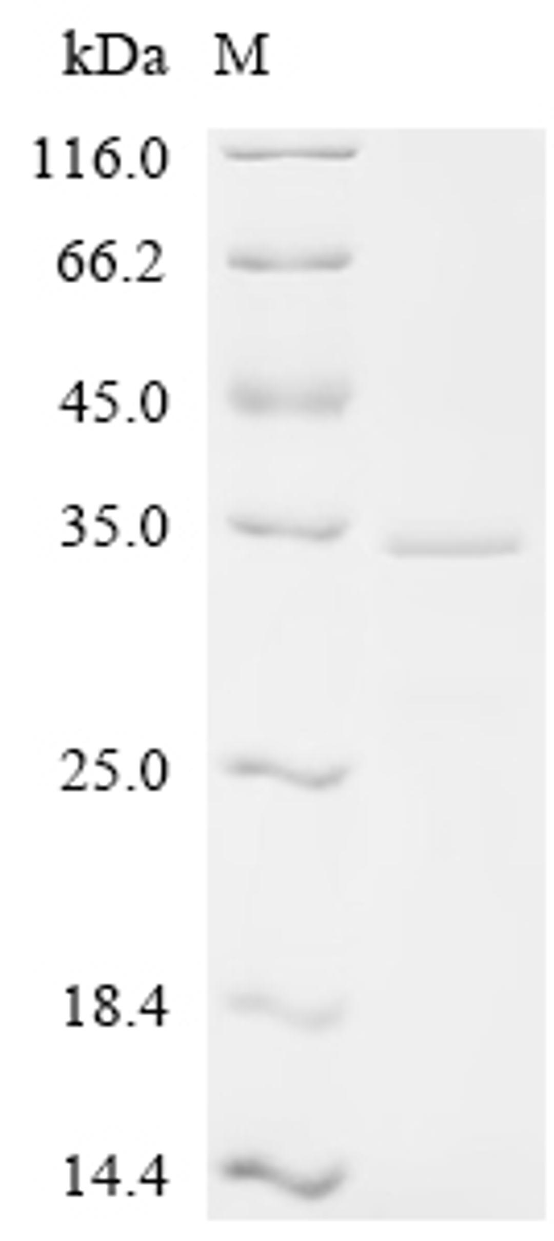 (Tris-Glycine gel) Discontinuous SDS-PAGE (reduced) with 5% enrichment gel and 15% separation gel.