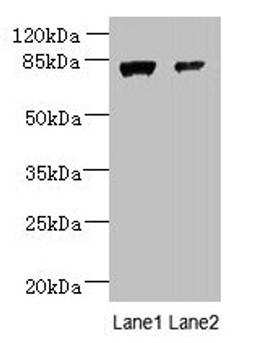 Western blot. All lanes: WDR49 antibody at 7µg/ml. Lane 1: A549 whole cell lysate. Lane 2: Hela whole cell lysate. Secondary. Goat polyclonal to rabbit IgG at 1/10000 dilution. Predicted band size: 80, 60 kDa. Observed band size: 80 kDa