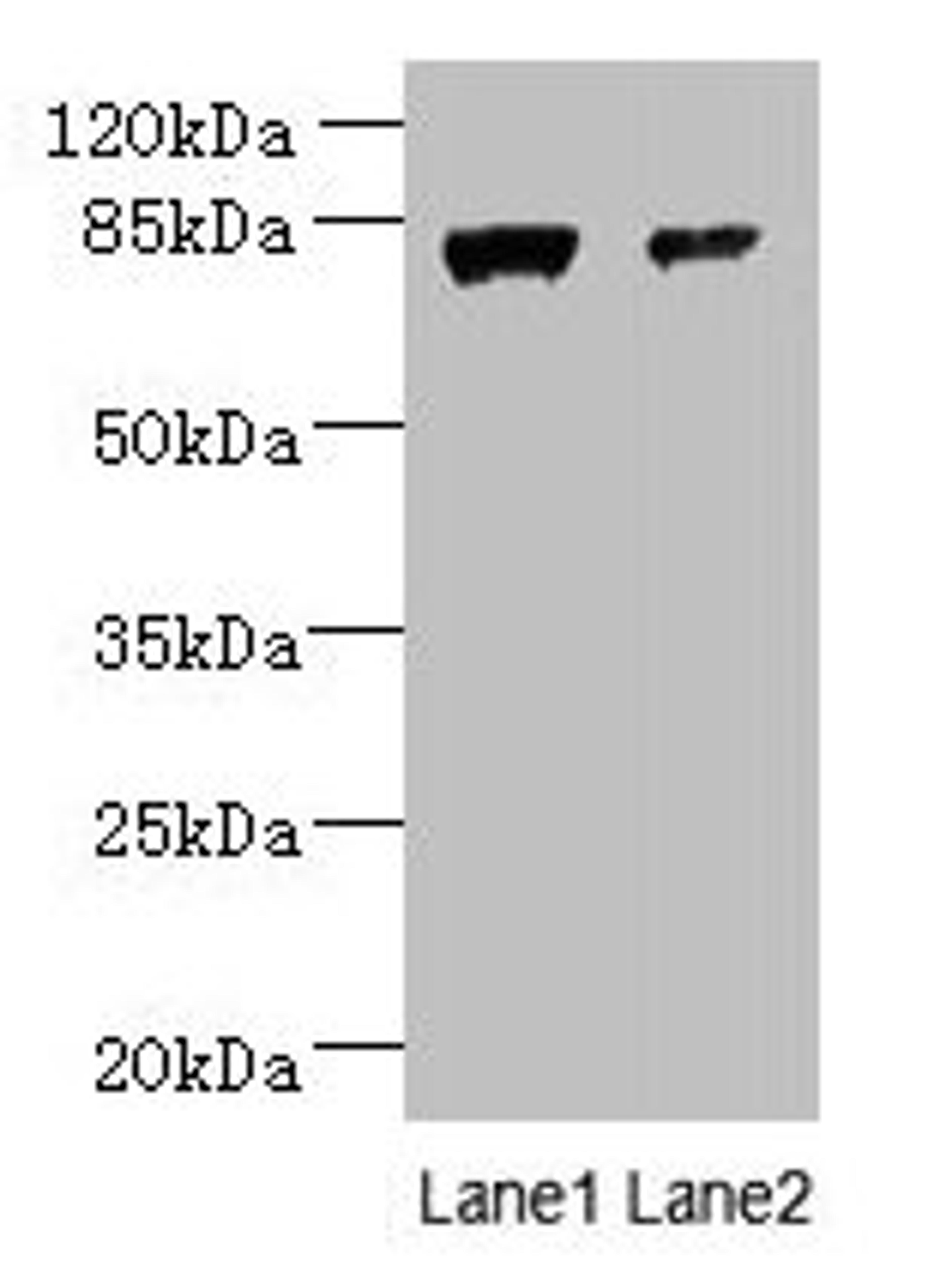Western blot. All lanes: WDR49 antibody at 7µg/ml. Lane 1: A549 whole cell lysate. Lane 2: Hela whole cell lysate. Secondary. Goat polyclonal to rabbit IgG at 1/10000 dilution. Predicted band size: 80, 60 kDa. Observed band size: 80 kDa