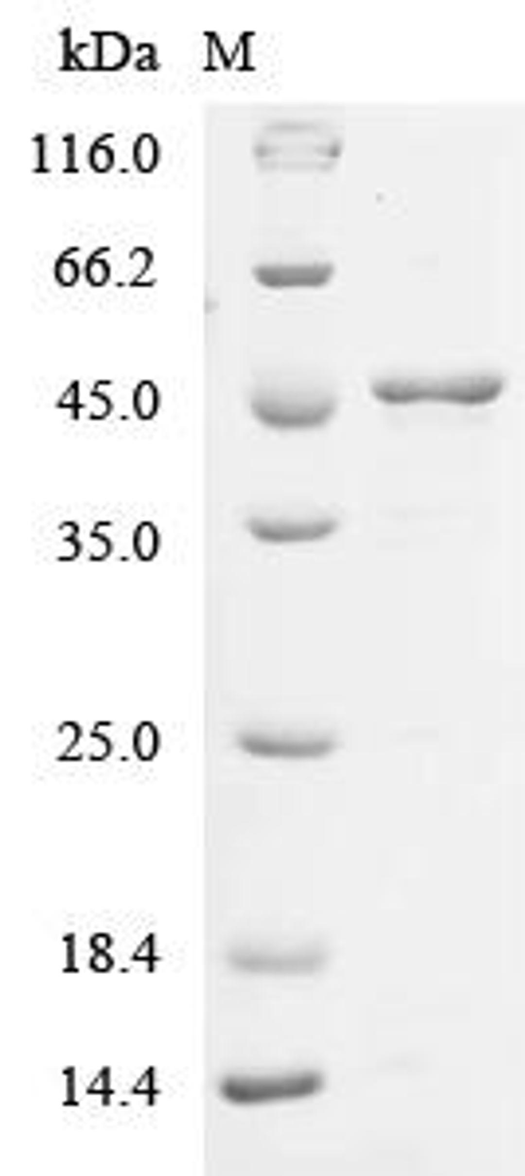 (Tris-Glycine gel) Discontinuous SDS-PAGE (reduced) with 5% enrichment gel and 15% separation gel.