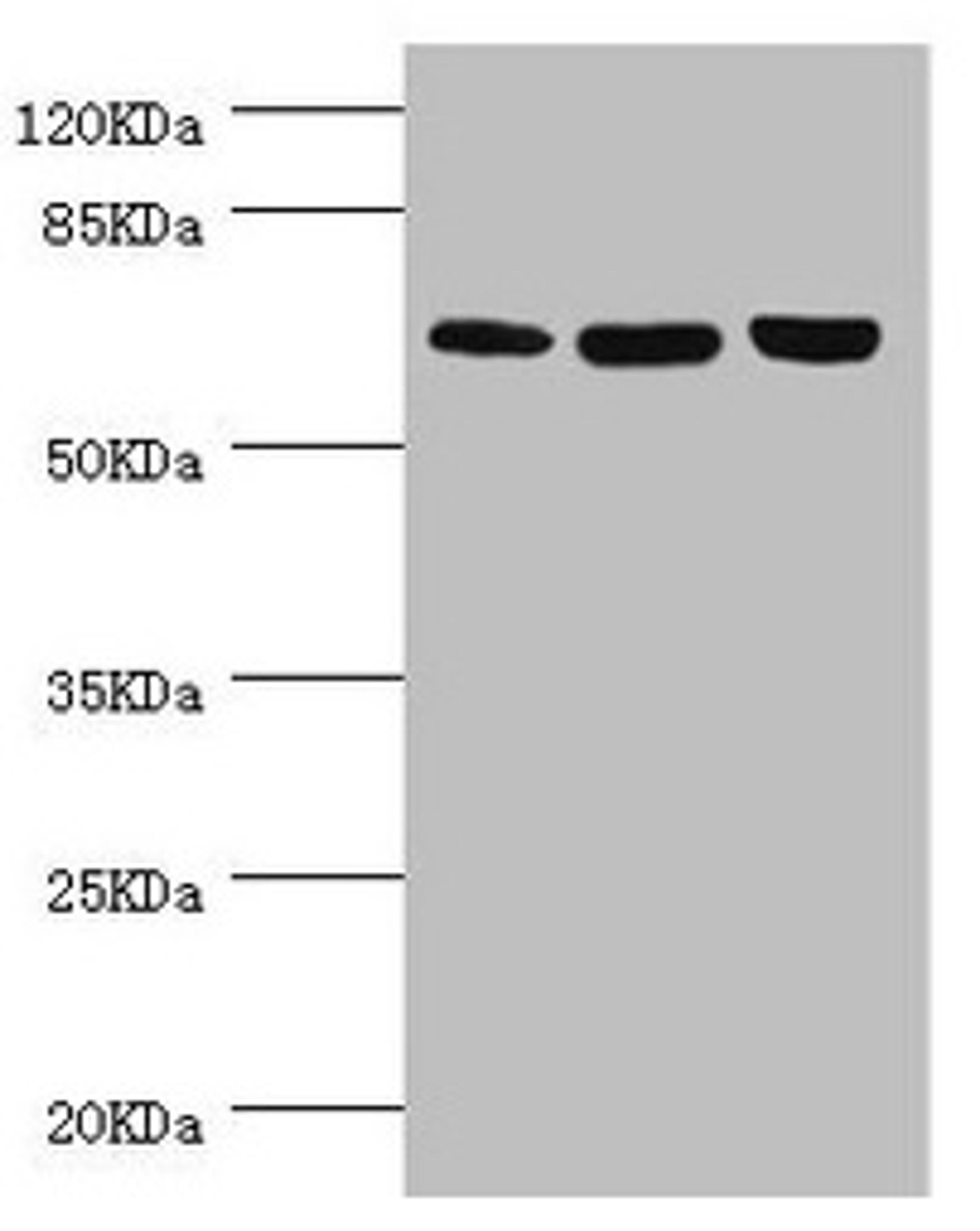 Western blot. All lanes: CTNNBL1 antibody at 5.39µg/ml. Lane 1: Hela whole cell lysate. Lane 2: Jurkat whole cell lysate. Lane 3: 293T whole cell lysate. Secondary. Goat polyclonal to rabbit IgG at 1/10000 dilution. Predicted band size: 66, 44, 37, 62 kDa. Observed band size: 66 kDa