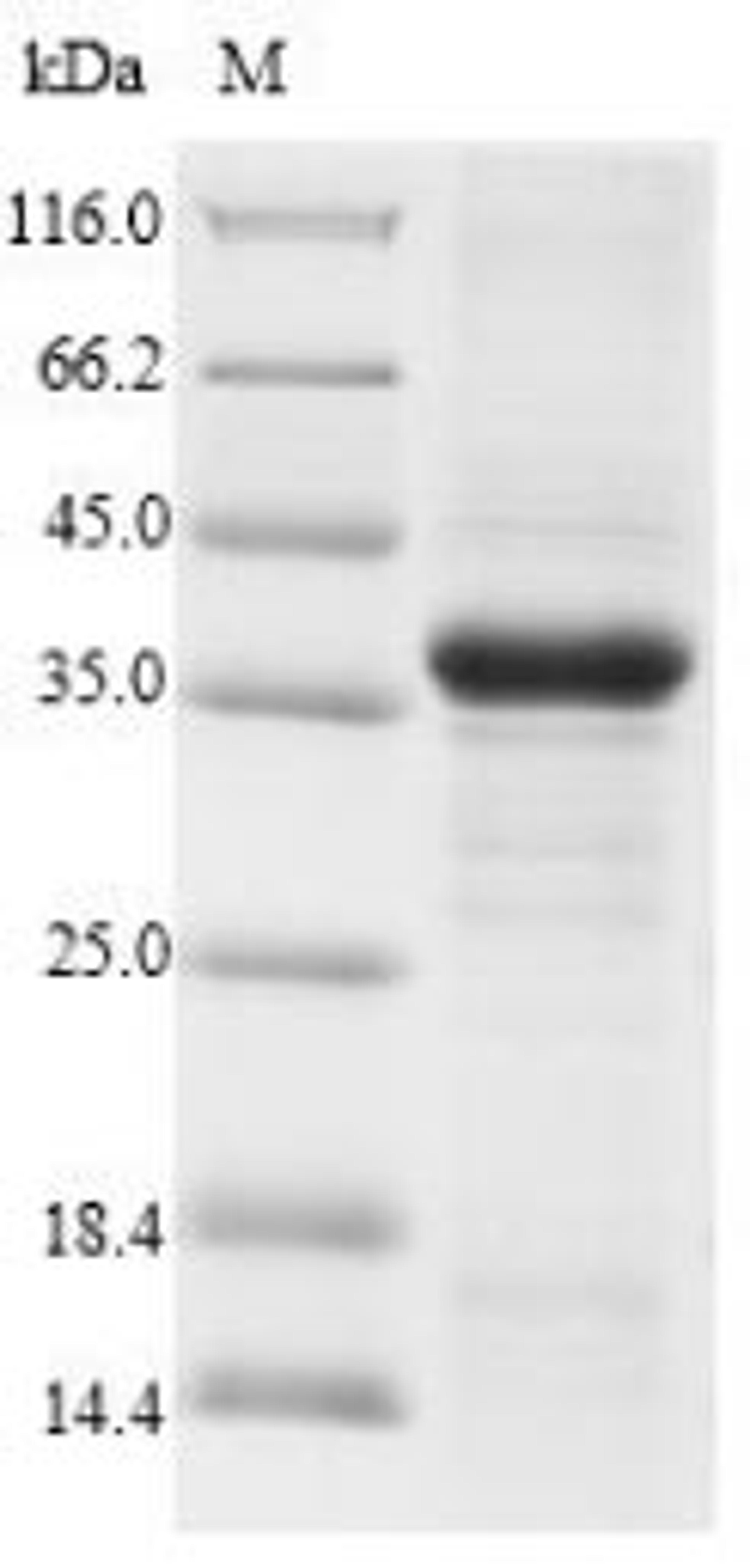 (Tris-Glycine gel) Discontinuous SDS-PAGE (reduced) with 5% enrichment gel and 15% separation gel.
