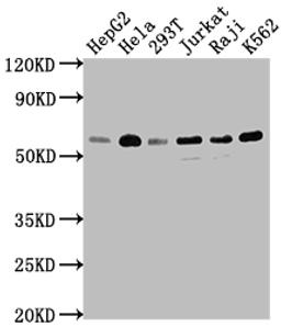 Western Blot. Positive WB detected in: HepG2 whole cell lysate, Hela whole cell lysate, 293T whole cell lysate, Jurkat whole cell lysate, Raji whole cell lysate, K562 whole cell lysate. All lanes: TRAF2 antibody at 1:1500. Secondary. Goat polyclonal to rabbit IgG at 1/50000 dilution. Predicted band size: 56, 62, 55, 54 kDa. Observed band size: 56 kDa. 