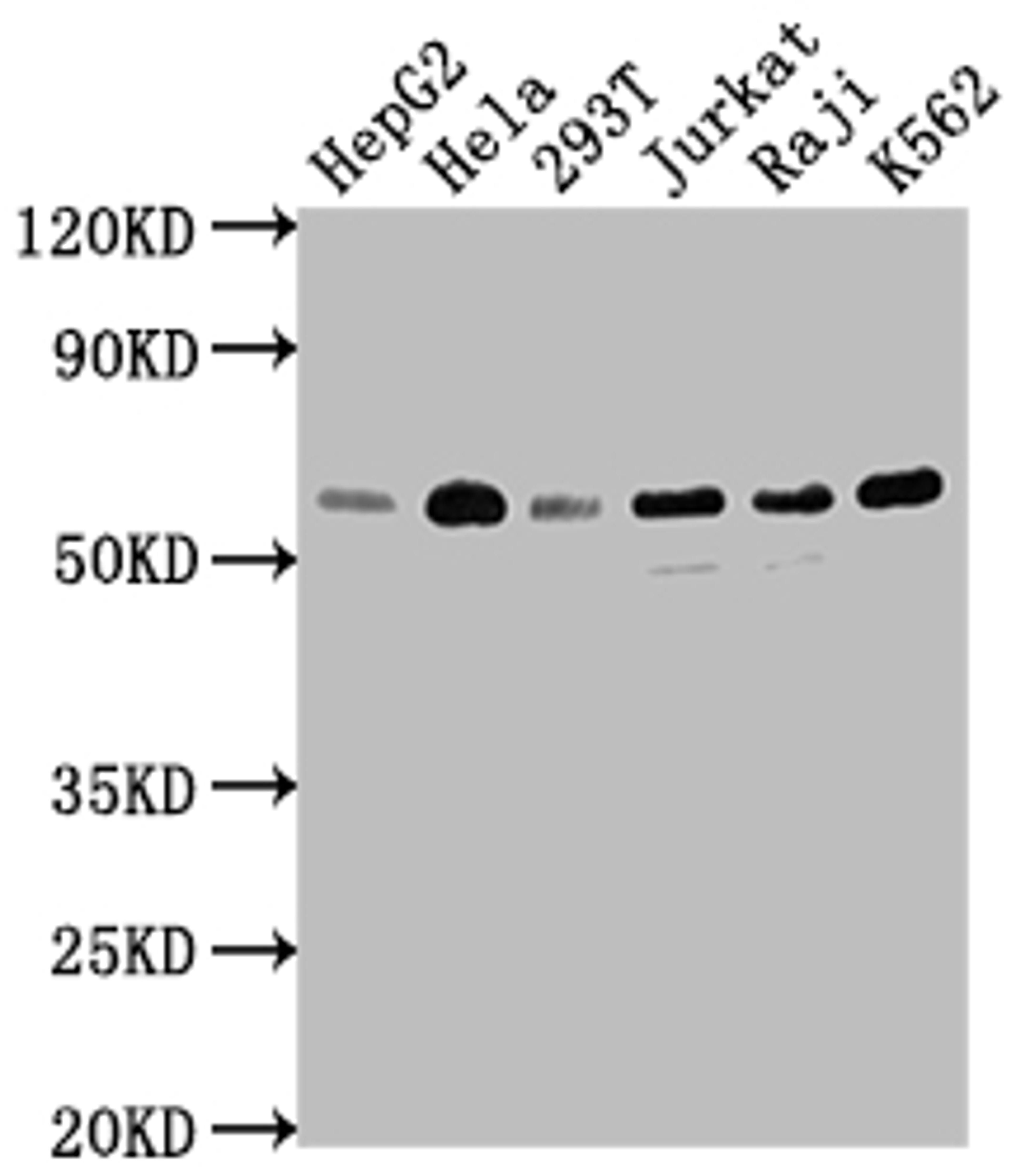 Western Blot. Positive WB detected in: HepG2 whole cell lysate, Hela whole cell lysate, 293T whole cell lysate, Jurkat whole cell lysate, Raji whole cell lysate, K562 whole cell lysate. All lanes: TRAF2 antibody at 1:1500. Secondary. Goat polyclonal to rabbit IgG at 1/50000 dilution. Predicted band size: 56, 62, 55, 54 kDa. Observed band size: 56 kDa. 