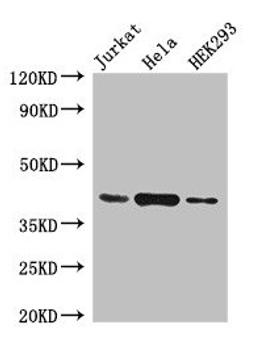 Western Blot. Positive WB detected in: Jurkat whole cell lysate, Hela whole cell lysate, HEK293 whole cell lysate. All lanes: HLA-C antibody at 4µg/ml. Secondary. Goat polyclonal to rabbit IgG at 1/50000 dilution. Predicted band size: 41 kDa. Observed band size: 41 kDa