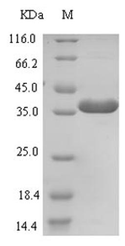(Tris-Glycine gel) Discontinuous SDS-PAGE (reduced) with 5% enrichment gel and 15% separation gel.