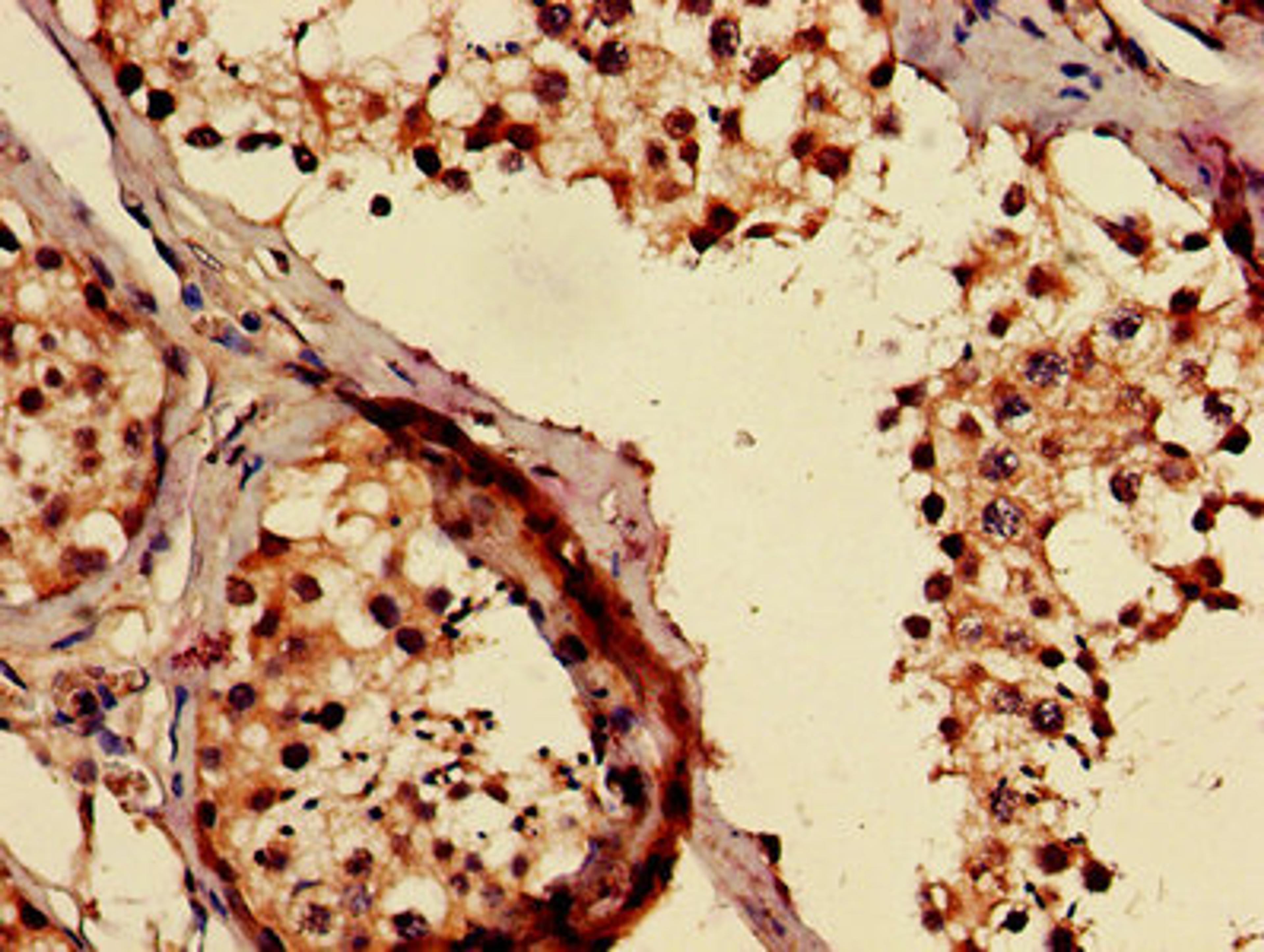 IHC image of CSB-PA891784LA01HU diluted at 1:500 and staining in paraffin-embedded human testis tissue performed on a Leica BondTM system. After dewaxing and hydration, antigen retrieval was mediated by high pressure in a citrate buffer (pH 6.0). Section was blocked with 10% normal goat serum 30min at RT. Then primary antibody (1% BSA) was incubated at 4&deg;C overnight. The primary is detected by a biotinylated secondary antibody and visualized using an HRP conjugated SP system.