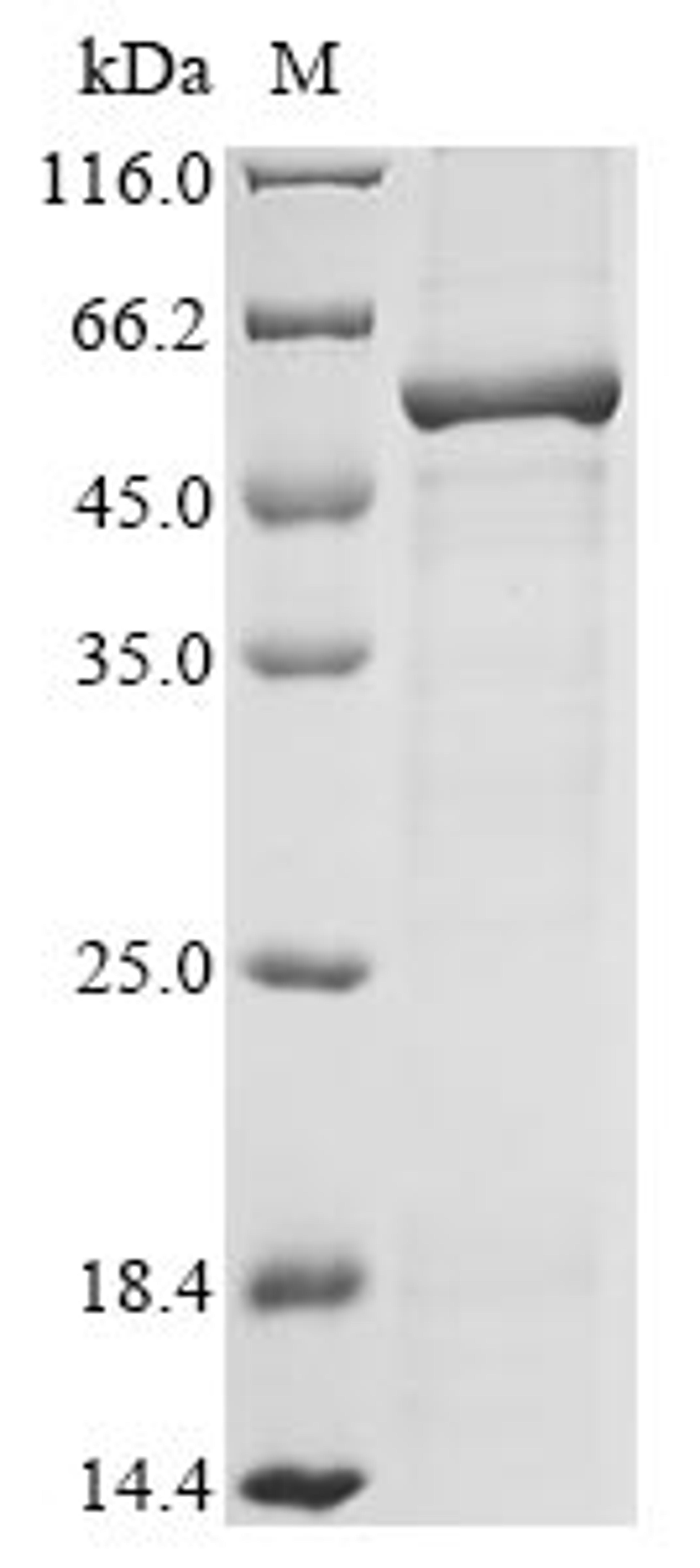 (Tris-Glycine gel) Discontinuous SDS-PAGE (reduced) with 5% enrichment gel and 15% separation gel.