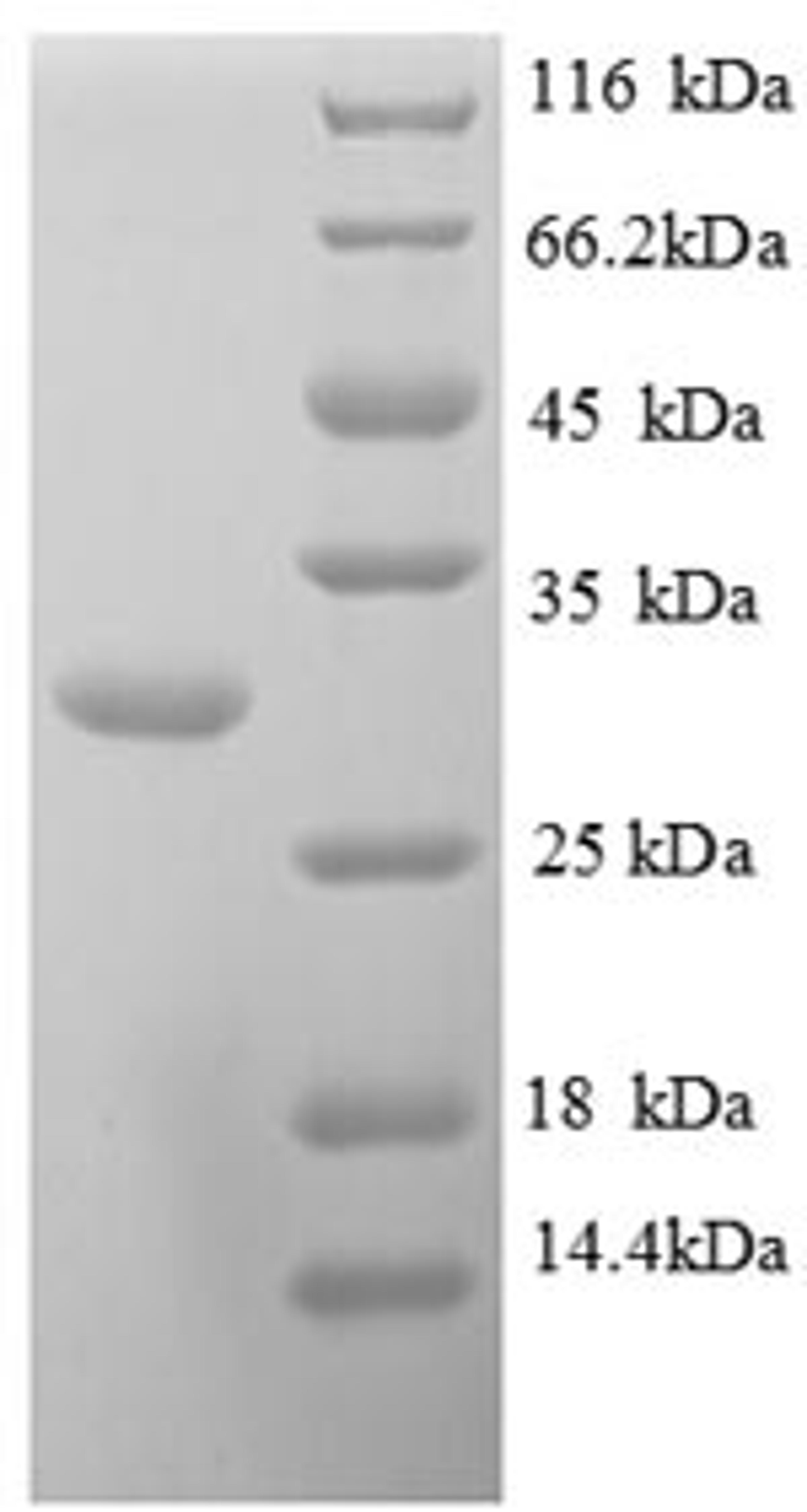 (Tris-Glycine gel) Discontinuous SDS-PAGE (reduced) with 5% enrichment gel and 15% separation gel.