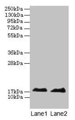 Western blot. All lanes: MB antibody at 2µg/ml. Lane 1: Rat skeletal muscle tissue. Lane 2: Mouse heart tissue. Secondary. Goat polyclonal to rabbit IgG at 1/10000 dilution. Predicted band size: 18 kDa. Observed band size: 18 kDa