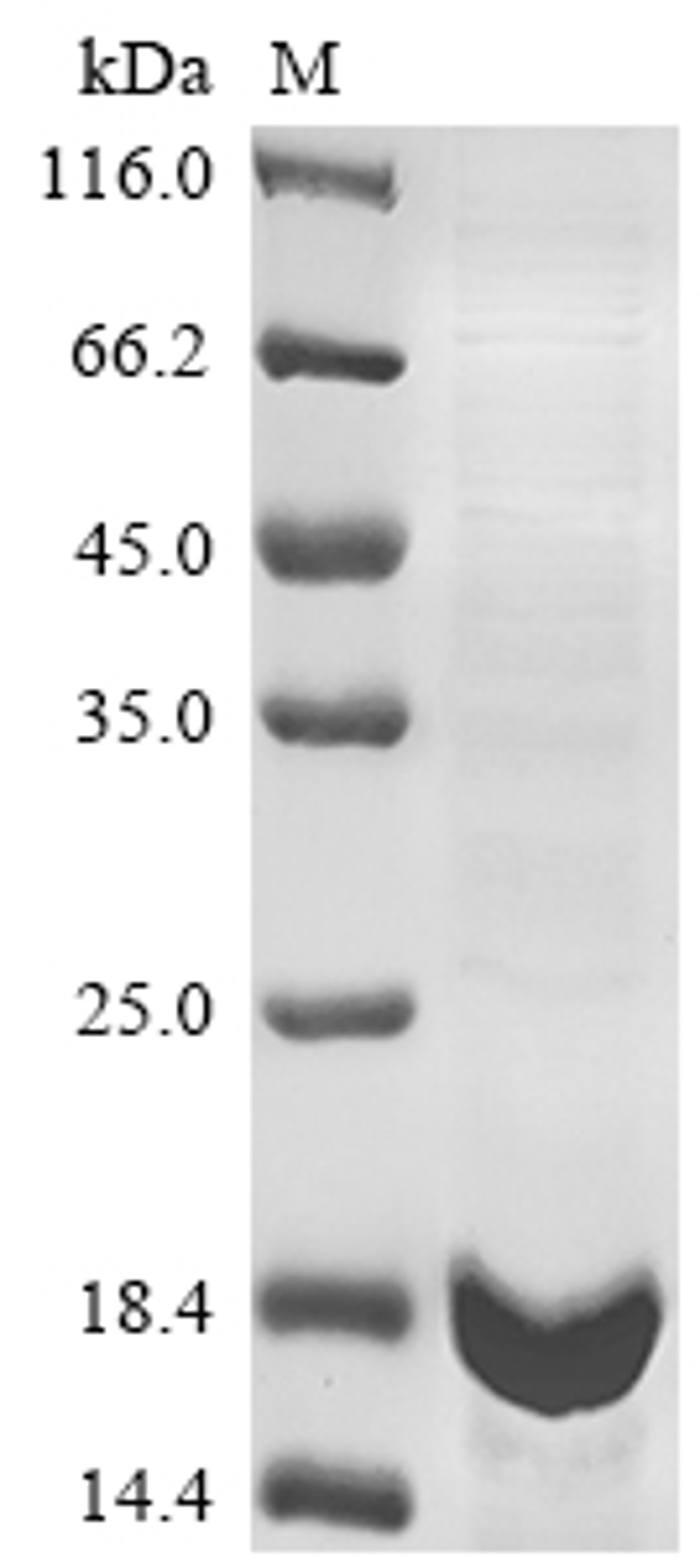 (Tris-Glycine gel) Discontinuous SDS-PAGE (reduced) with 5% enrichment gel and 15% separation gel.