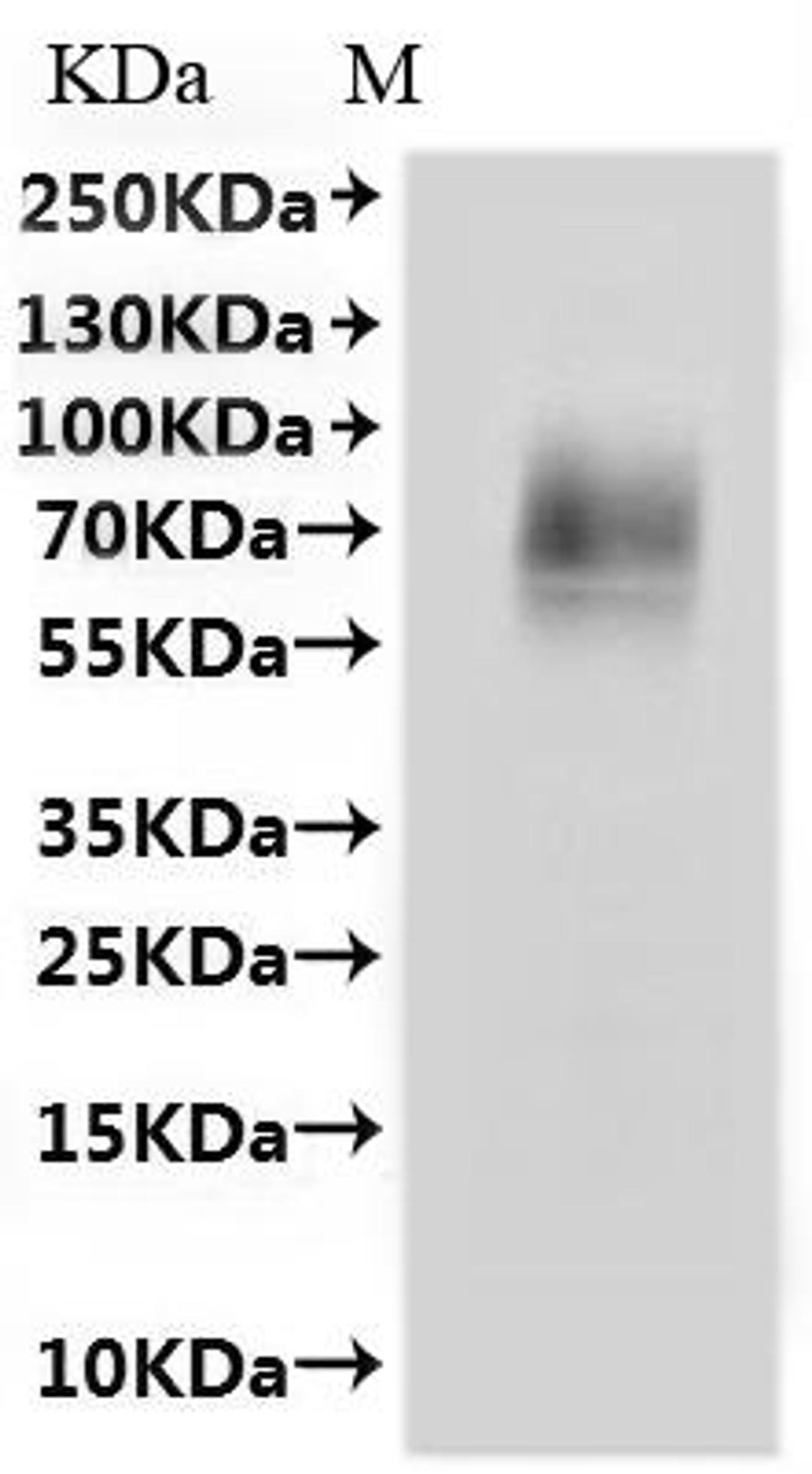 CSB-MP6049MOWd7 is detected by Mouse anti-6*His monoclonal antibody.