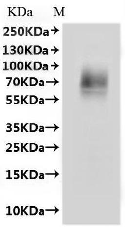 CSB-MP6049MOWd7 is detected by Mouse anti-6*His monoclonal antibody.