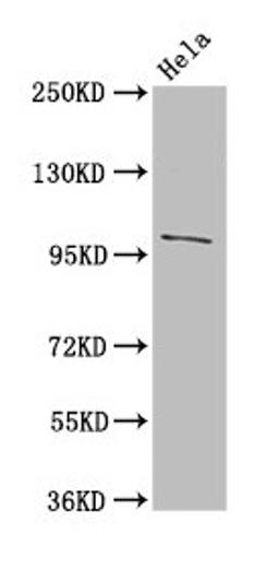 Western Blot. Positive WB detected in: Hela whole cell lysate. All lanes: NPC1 antibody at 3µg/ml. Secondary. Goat polyclonal to rabbit IgG at 1/50000 dilution. Predicted band size: 143, 108 kDa. Observed band size: 108 kDa