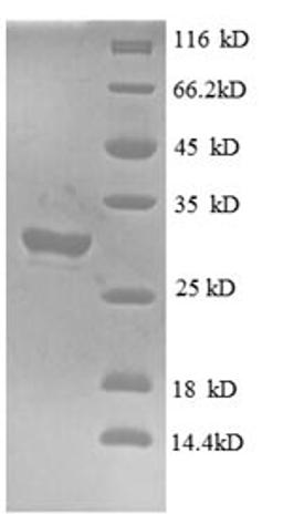 (Tris-Glycine gel) Discontinuous SDS-PAGE (reduced) with 5% enrichment gel and 15% separation gel.