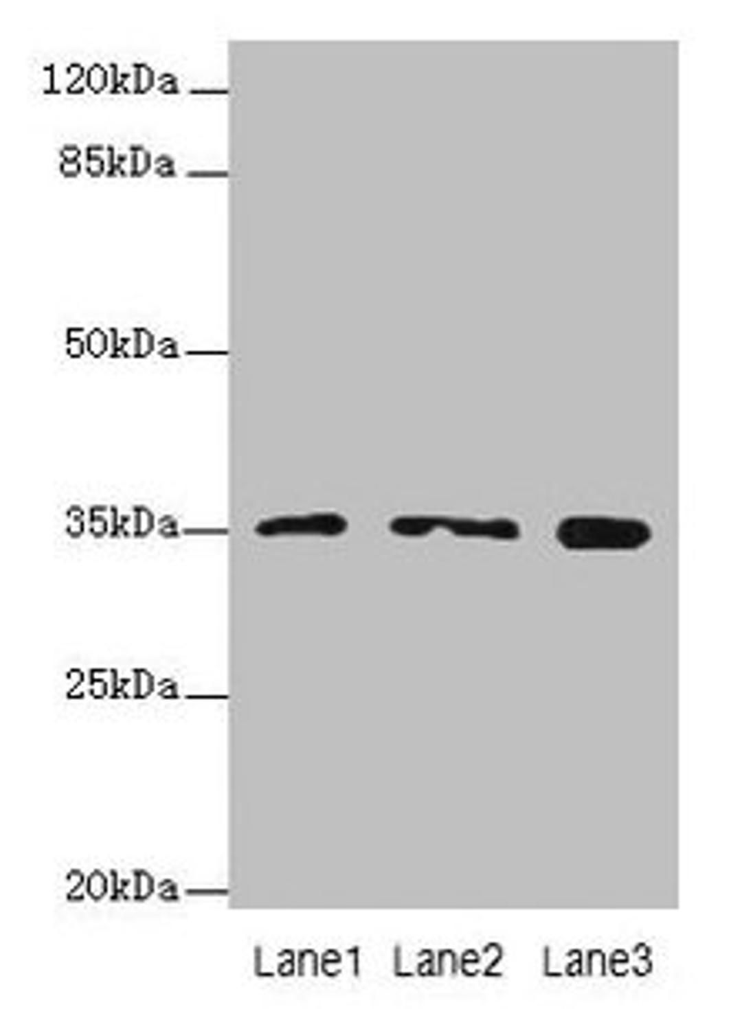 Western blot. All lanes: FAHD2A antibody at 0.5µg/ml. Lane 1: K562 whole cell lysate. Lane 2: U87 whole cell lysate. Lane 3: A549 whole cell lysate. Secondary. Goat polyclonal to rabbit IgG at 1/10000 dilution. Predicted band size: 35 kDa. Observed band size: 35 kDa