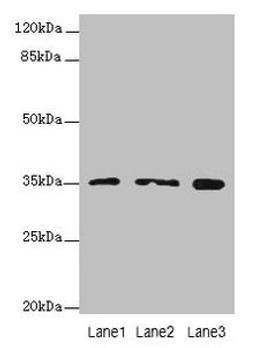 Western blot. All lanes: FAHD2A antibody at 0.5µg/ml. Lane 1: K562 whole cell lysate. Lane 2: U87 whole cell lysate. Lane 3: A549 whole cell lysate. Secondary. Goat polyclonal to rabbit IgG at 1/10000 dilution. Predicted band size: 35 kDa. Observed band size: 35 kDa