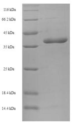 (Tris-Glycine gel) Discontinuous SDS-PAGE (reduced) with 5% enrichment gel and 15% separation gel.