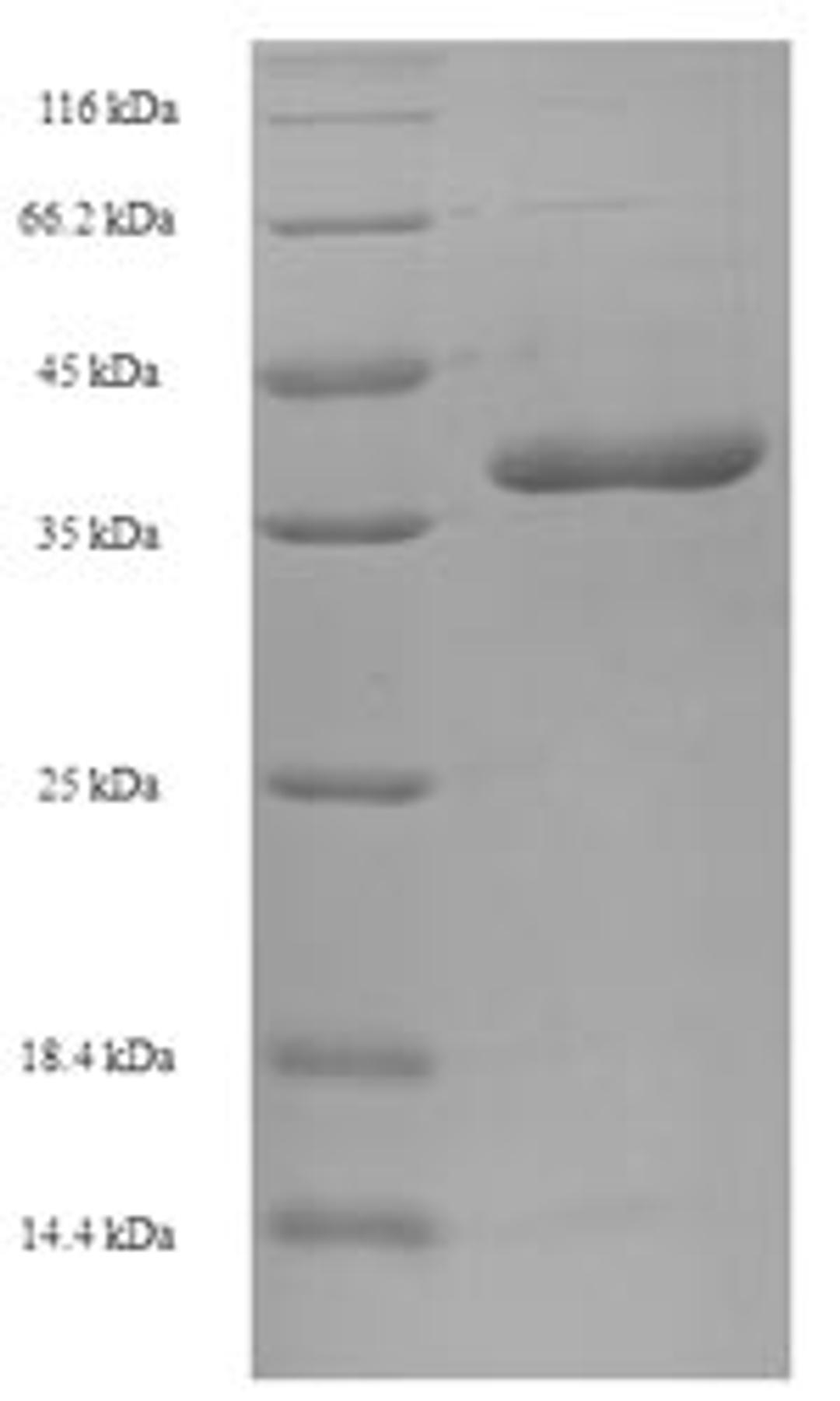 (Tris-Glycine gel) Discontinuous SDS-PAGE (reduced) with 5% enrichment gel and 15% separation gel.