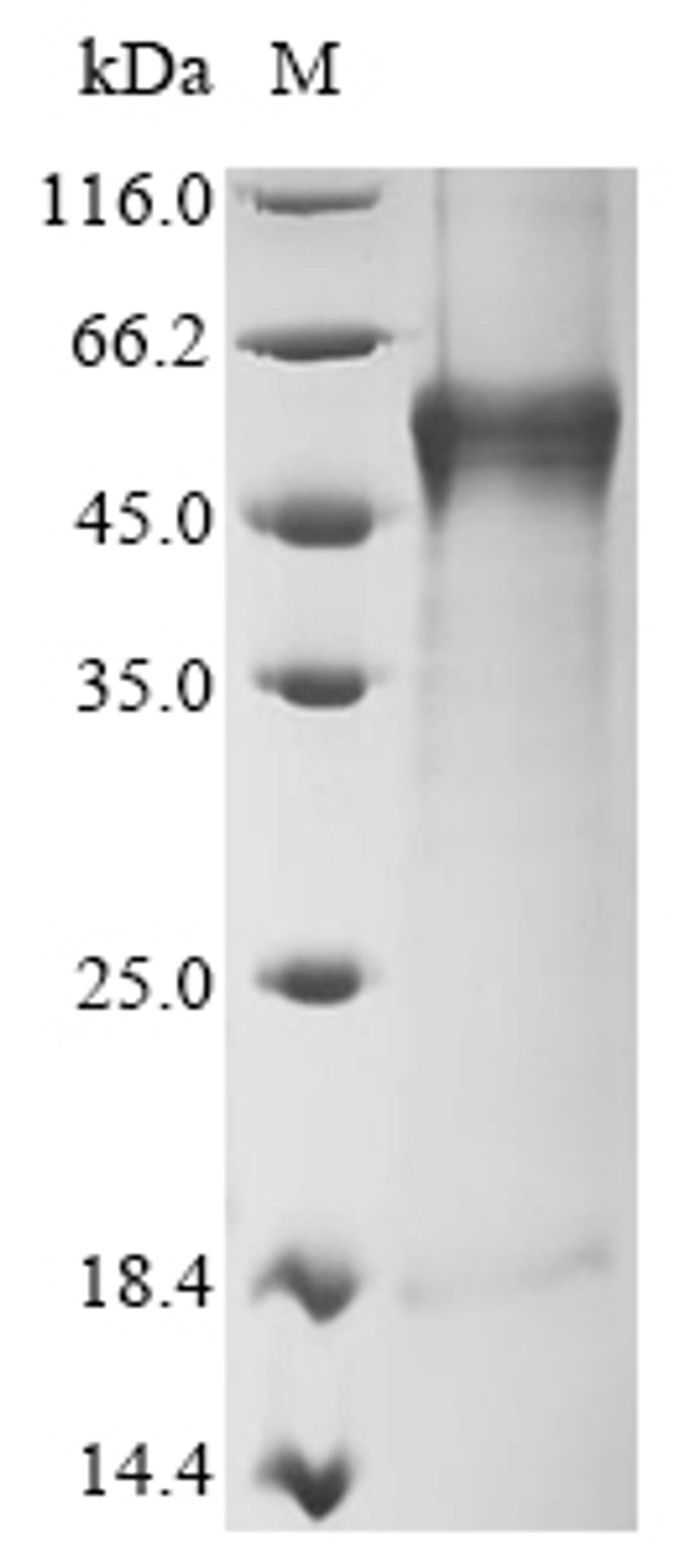 (Tris-Glycine gel) Discontinuous SDS-PAGE (reduced) with 5% enrichment gel and 15% separation gel.