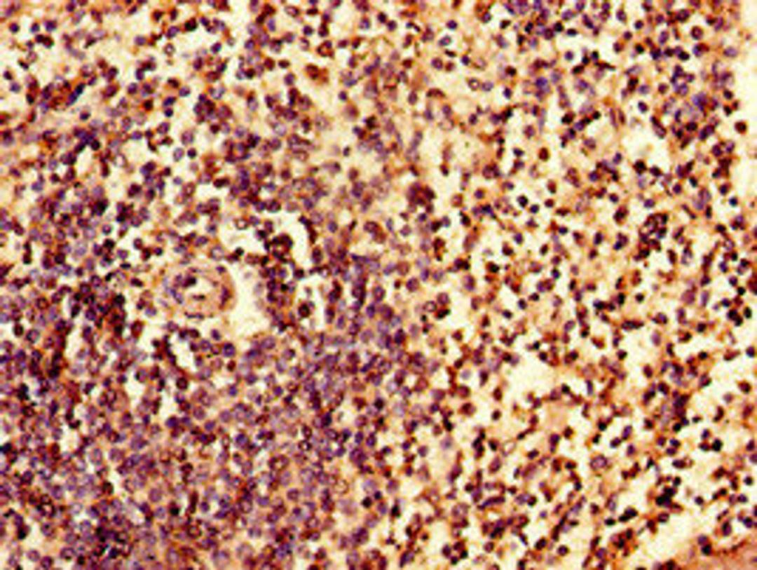 Immunohistochemistry of paraffin-embedded human spleen tissue using CSB-PA011822LA01HU at dilution of 1:100