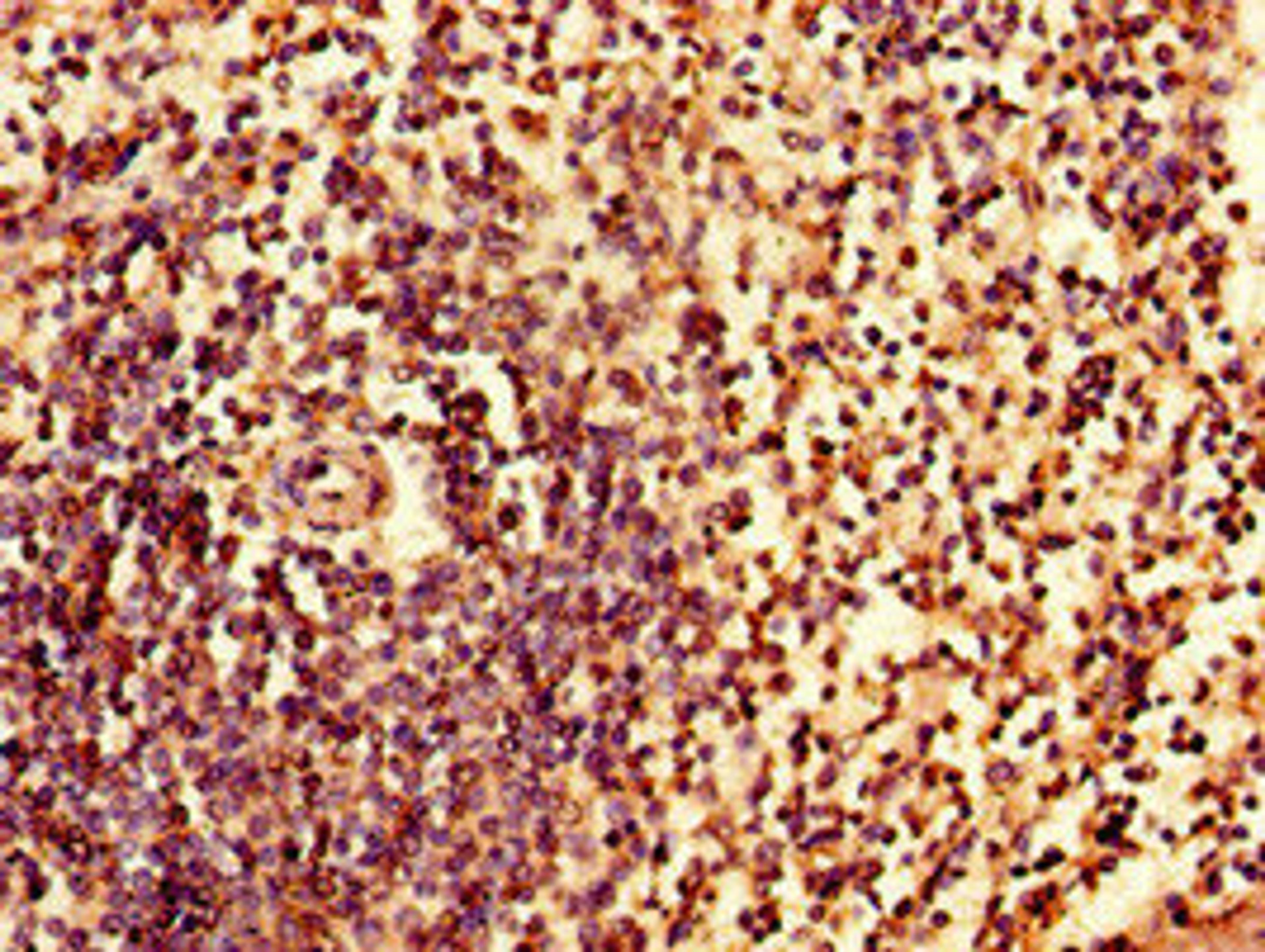 Immunohistochemistry of paraffin-embedded human spleen tissue using CSB-PA011822LA01HU at dilution of 1:100