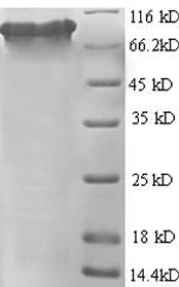 (Tris-Glycine gel) Discontinuous SDS-PAGE (reduced) with 5% enrichment gel and 15% separation gel.