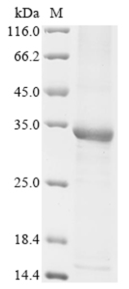 (Tris-Glycine gel) Discontinuous SDS-PAGE (reduced) with 5% enrichment gel and 15% separation gel.