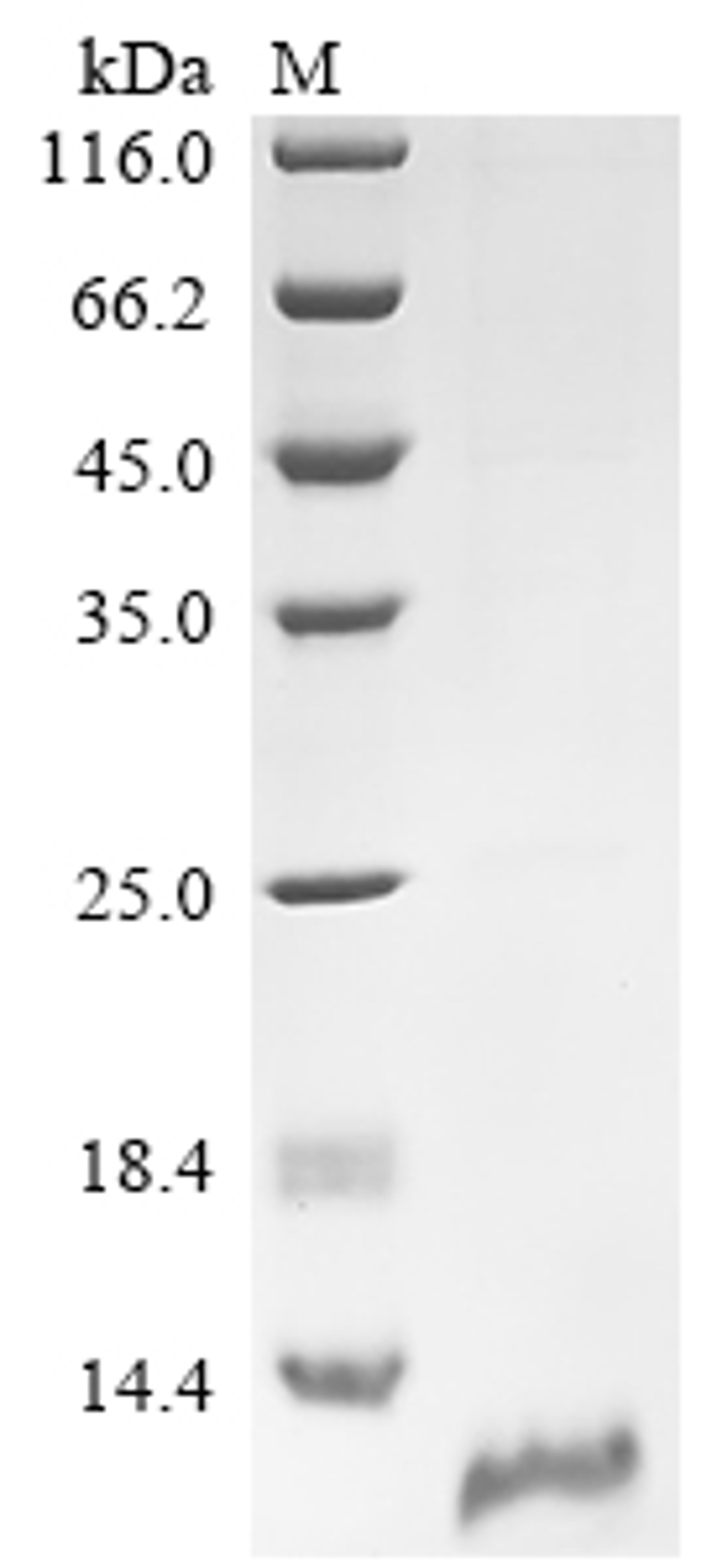 (Tris-Glycine gel) Discontinuous SDS-PAGE (reduced) with 5% enrichment gel and 15% separation gel.