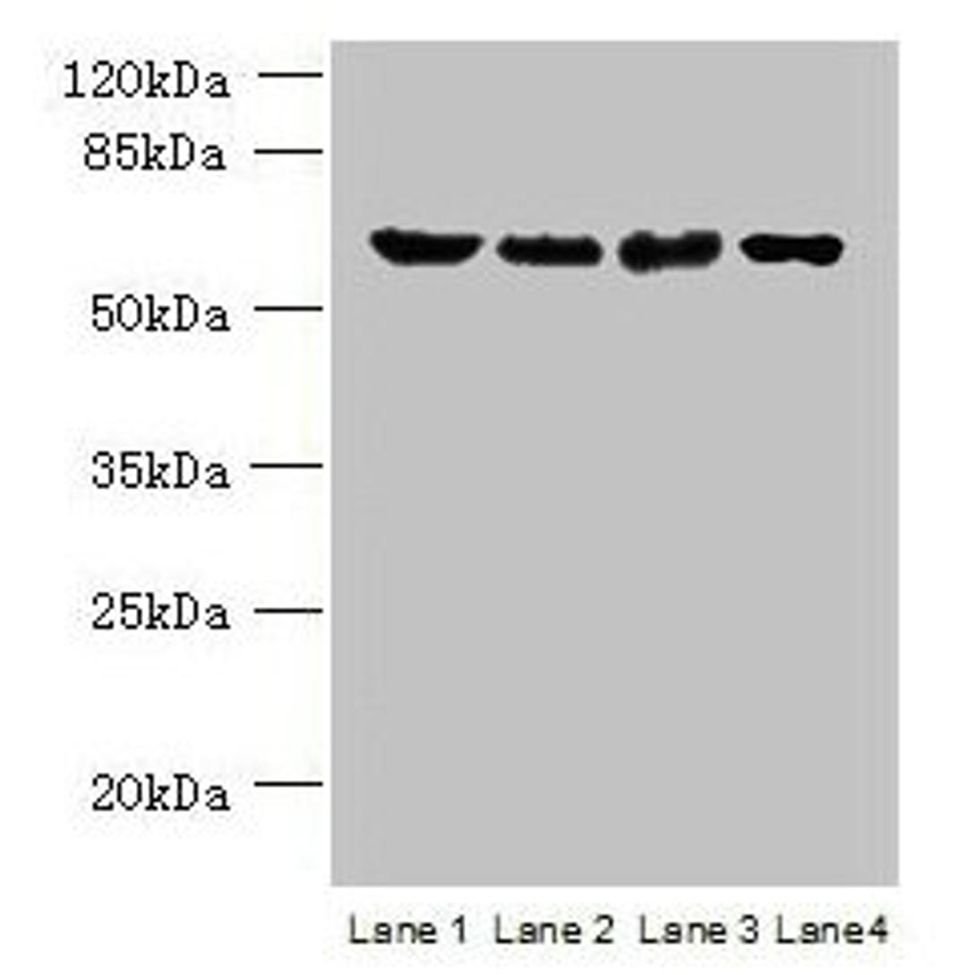 Western blot. All lanes: POLR3C antibody at 2µg/ml. Lane 1: 293T whole cell lysate. Lane 2: Hela whole cell lysate. Lane 3: Mouse brain tissue. Lane 4: THP-1 whole cell lysate. Secondary. Goat polyclonal to rabbit IgG at 1/10000 dilution. Predicted band size: 61 kDa. Observed band size: 61 kDa