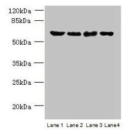 Western blot. All lanes: POLR3C antibody at 2µg/ml. Lane 1: 293T whole cell lysate. Lane 2: Hela whole cell lysate. Lane 3: Mouse brain tissue. Lane 4: THP-1 whole cell lysate. Secondary. Goat polyclonal to rabbit IgG at 1/10000 dilution. Predicted band size: 61 kDa. Observed band size: 61 kDa