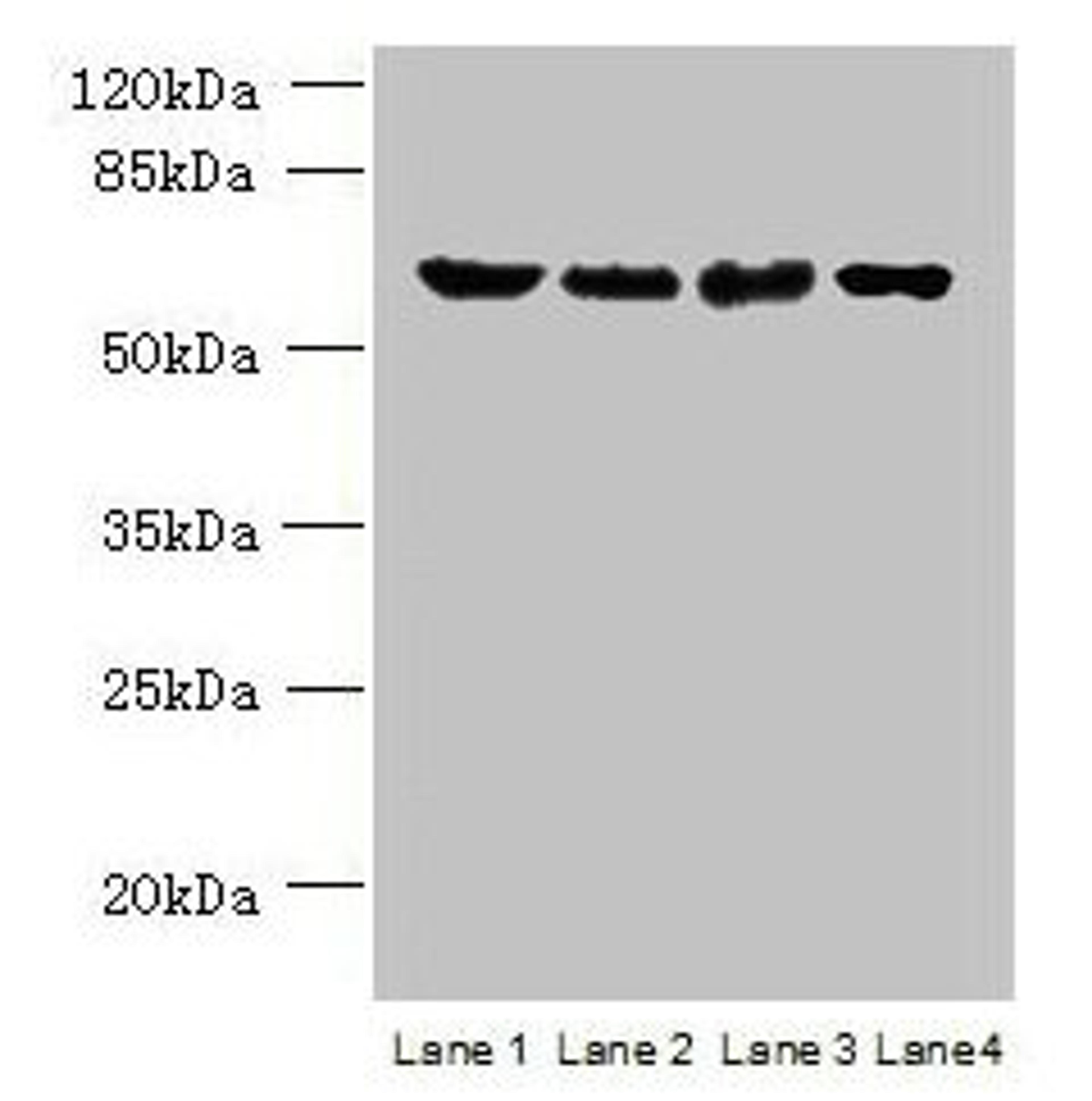 Western blot. All lanes: POLR3C antibody at 2µg/ml. Lane 1: 293T whole cell lysate. Lane 2: Hela whole cell lysate. Lane 3: Mouse brain tissue. Lane 4: THP-1 whole cell lysate. Secondary. Goat polyclonal to rabbit IgG at 1/10000 dilution. Predicted band size: 61 kDa. Observed band size: 61 kDa