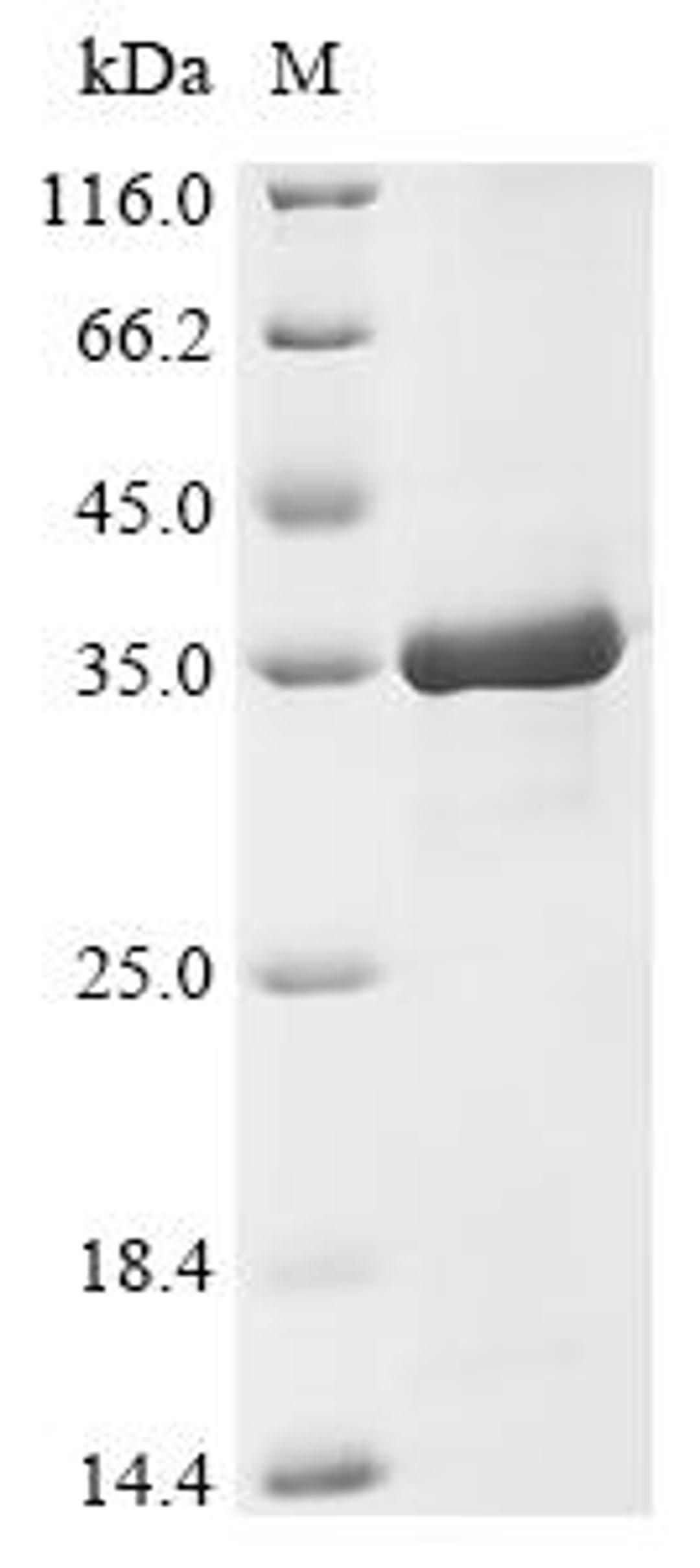 (Tris-Glycine gel) Discontinuous SDS-PAGE (reduced) with 5% enrichment gel and 15% separation gel.