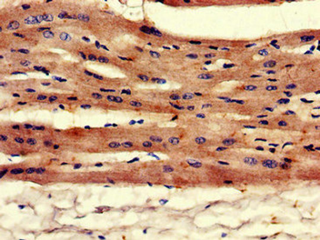 Immunohistochemistry of paraffin-embedded human heart tissue using CSB-PA13149A0Rb at dilution of 1:100