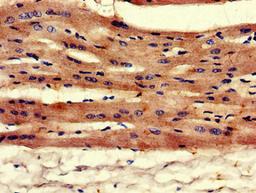 Immunohistochemistry of paraffin-embedded human heart tissue using CSB-PA13149A0Rb at dilution of 1:100