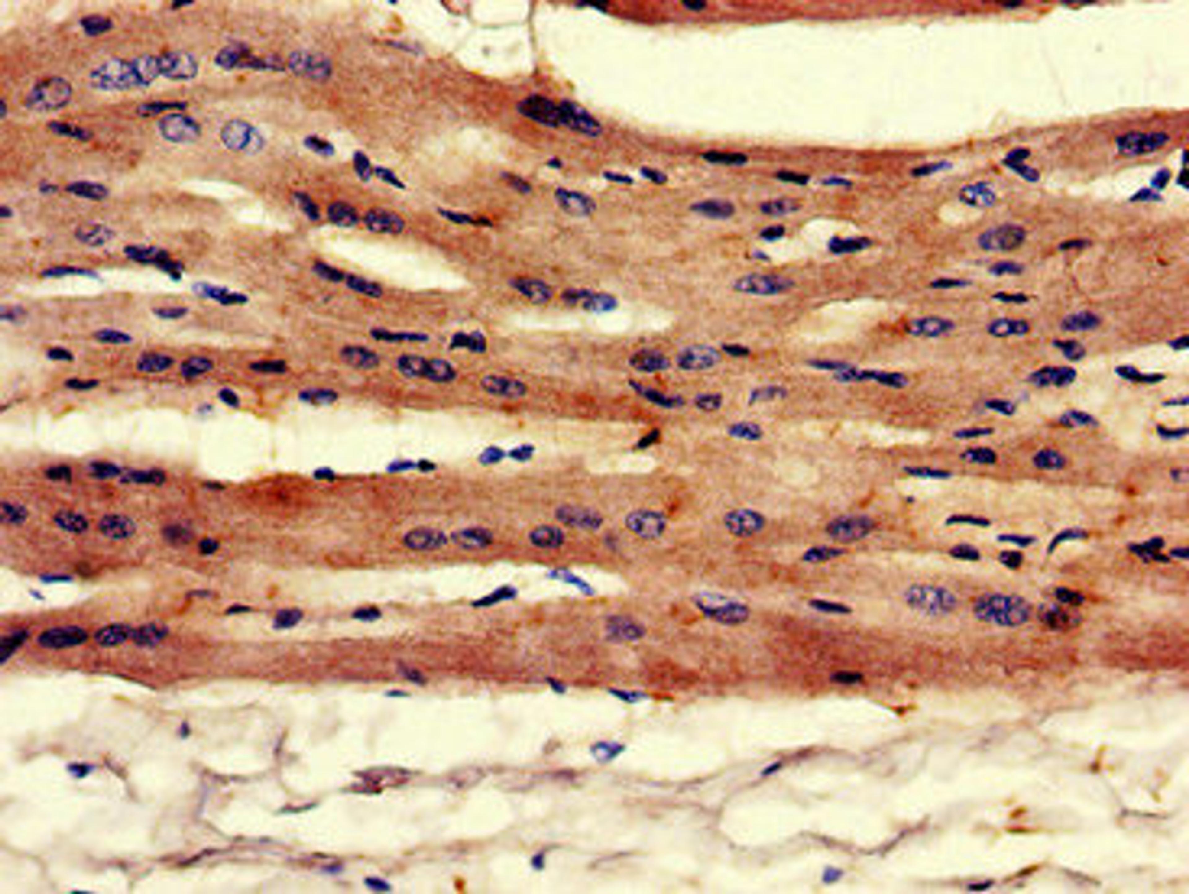 Immunohistochemistry of paraffin-embedded human heart tissue using CSB-PA13149A0Rb at dilution of 1:100