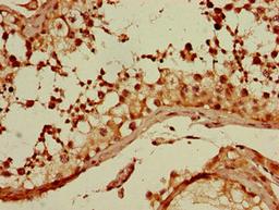 Immunohistochemistry of paraffin-embedded human testis tissue using CSB-PA009583LA01HU at dilution of 1:100