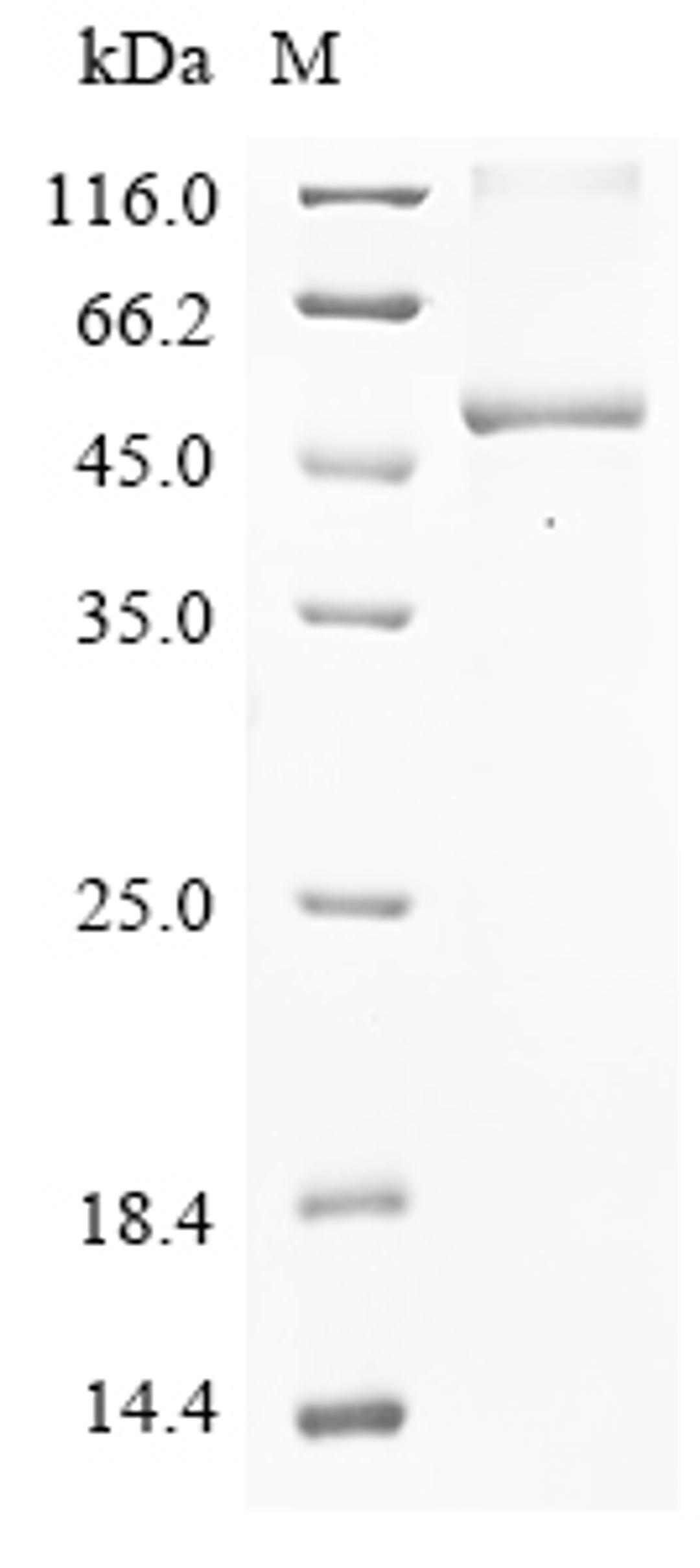 (Tris-Glycine gel) Discontinuous SDS-PAGE (reduced) with 5% enrichment gel and 15% separation gel.