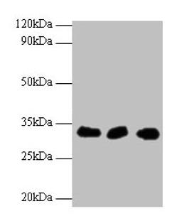 Western blot. All lanes: HUS1 antibody at 2µg/ml. Lane 1: Hela whole cell lysate. Lane 2: 293T whole cell lysate. Lane 2: A431 whole cell lysate. Secondary. Goat polyclonal to rabbit IgG at 1/10000 dilution. Predicted band size: 32, 30 kDa. Observed band size: 32 kDa