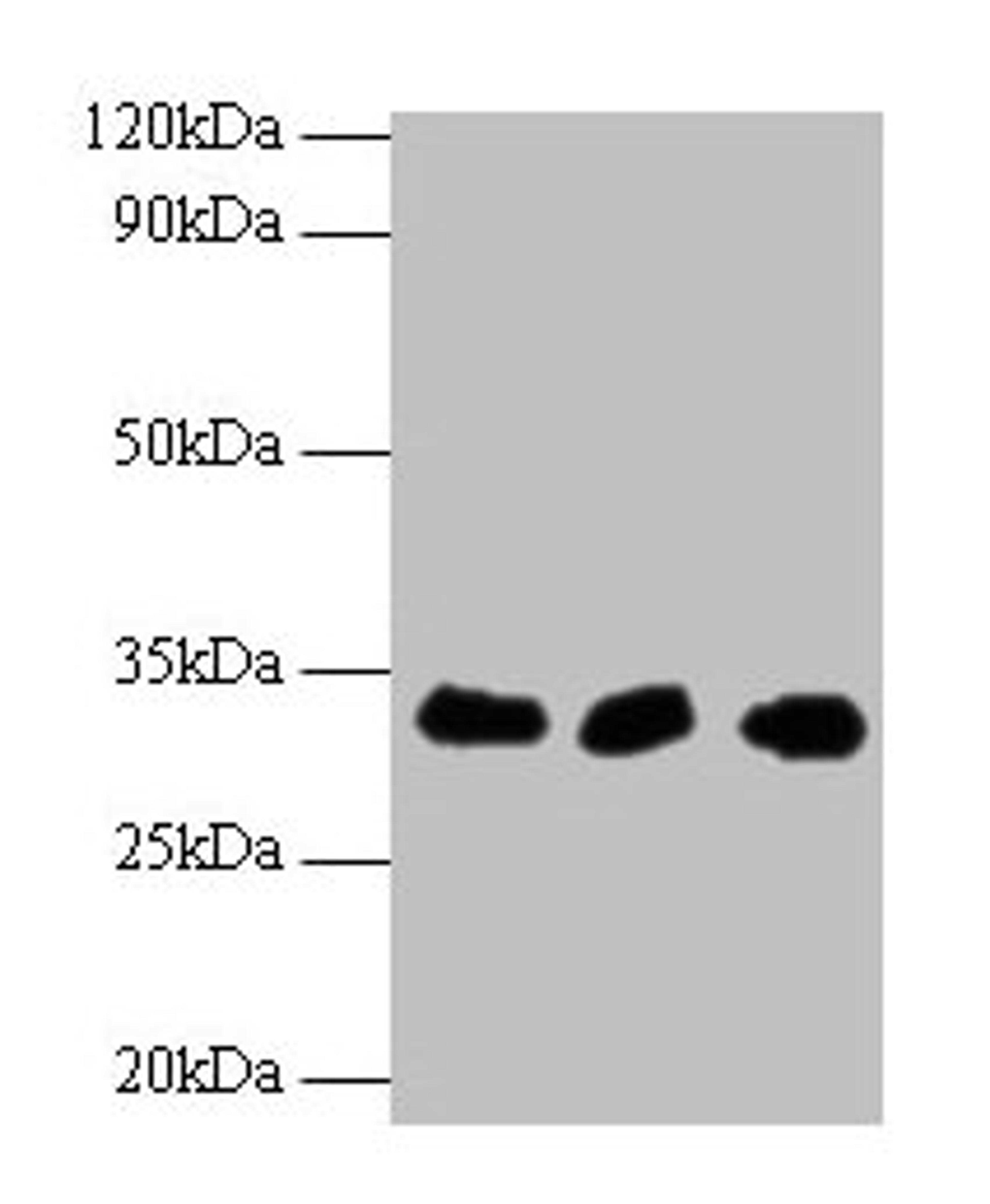 Western blot. All lanes: HUS1 antibody at 2µg/ml. Lane 1: Hela whole cell lysate. Lane 2: 293T whole cell lysate. Lane 2: A431 whole cell lysate. Secondary. Goat polyclonal to rabbit IgG at 1/10000 dilution. Predicted band size: 32, 30 kDa. Observed band size: 32 kDa