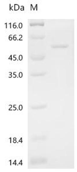 (Tris-Glycine gel) Discontinuous SDS-PAGE (reduced) with 5% enrichment gel and 15% separation gel.