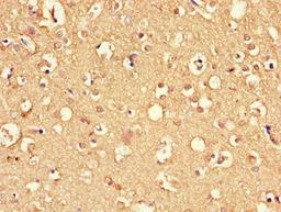 Immunohistochemistry of paraffin-embedded human brain tissue using CSB-PA007040LA01HU at dilution of 1:100