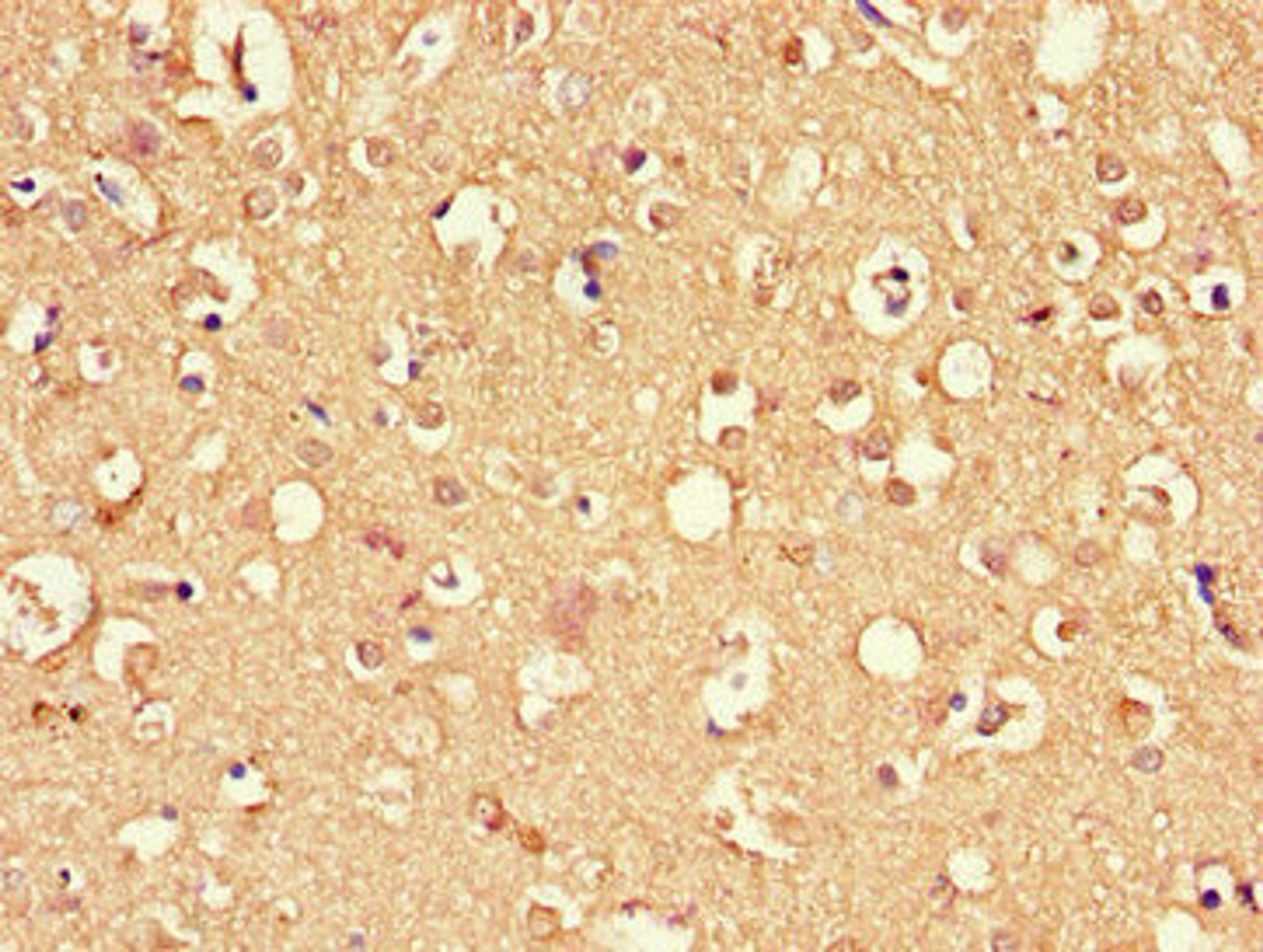 Immunohistochemistry of paraffin-embedded human brain tissue using CSB-PA007040LA01HU at dilution of 1:100