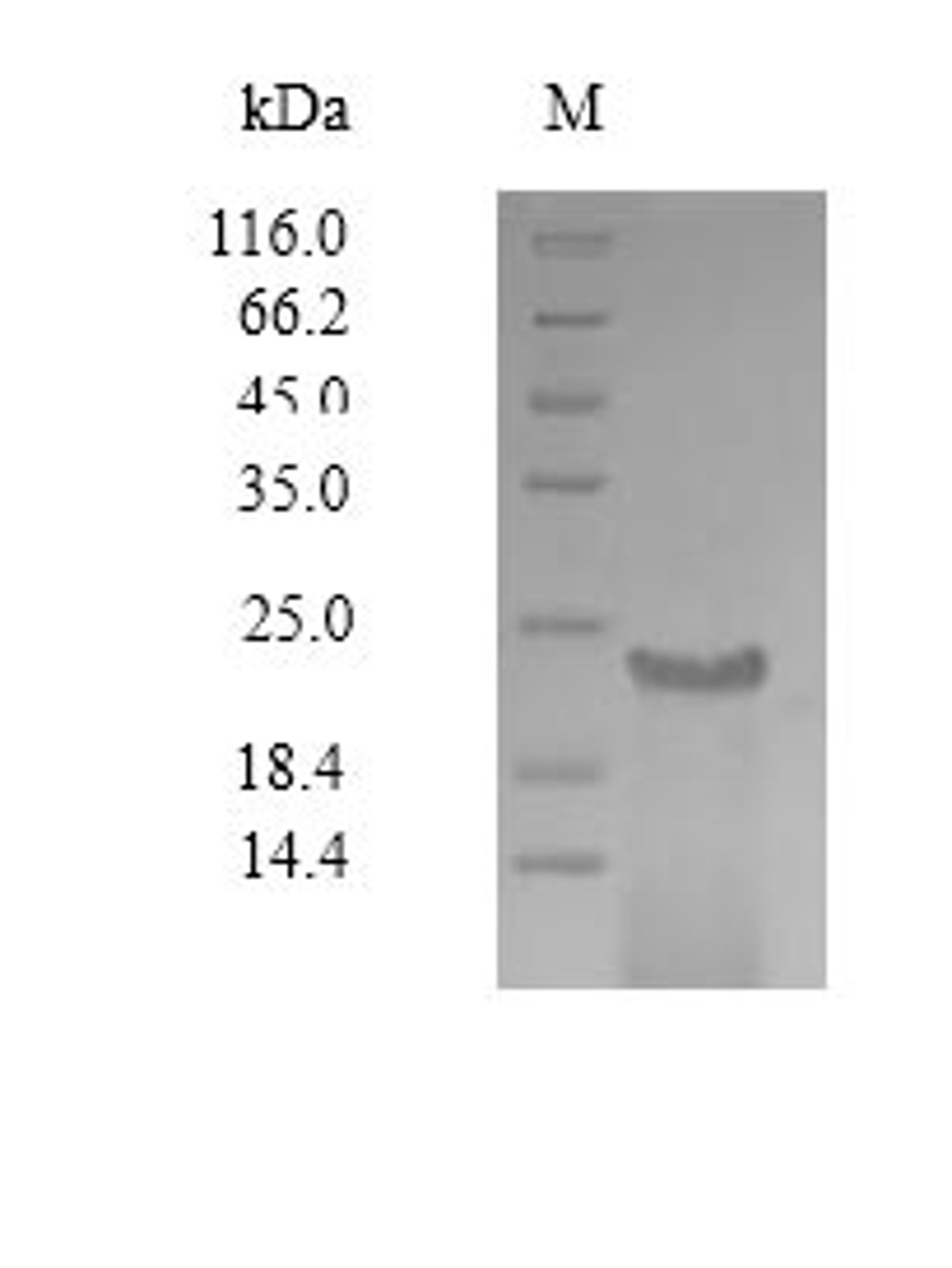 (Tris-Glycine gel) Discontinuous SDS-PAGE (reduced) with 5% enrichment gel and 15% separation gel.