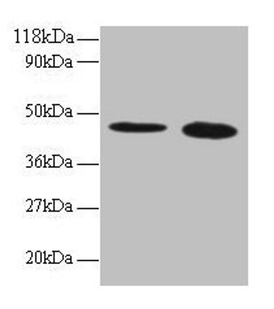 Western blot. All lanes: TTC1 antibody at 2µg/ml. Lane 1: 293T whole cell lysate. Lane 2: EC109 whole cell lysate. Secondary. Goat polyclonal to rabbit IgG at 1/15000 dilution. Predicted band size: 34 kDa. Observed band size: 45 kDa