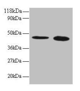 Western blot. All lanes: TTC1 antibody at 2µg/ml. Lane 1: 293T whole cell lysate. Lane 2: EC109 whole cell lysate. Secondary. Goat polyclonal to rabbit IgG at 1/15000 dilution. Predicted band size: 34 kDa. Observed band size: 45 kDa