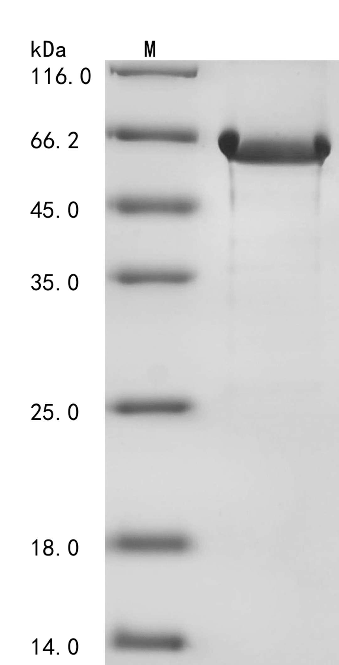 (Tris-Glycine gel) Discontinuous SDS-PAGE (reduced) with 5% enrichment gel and 15% separation gel.